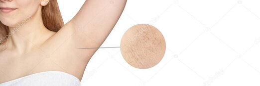 Website redesign before and after